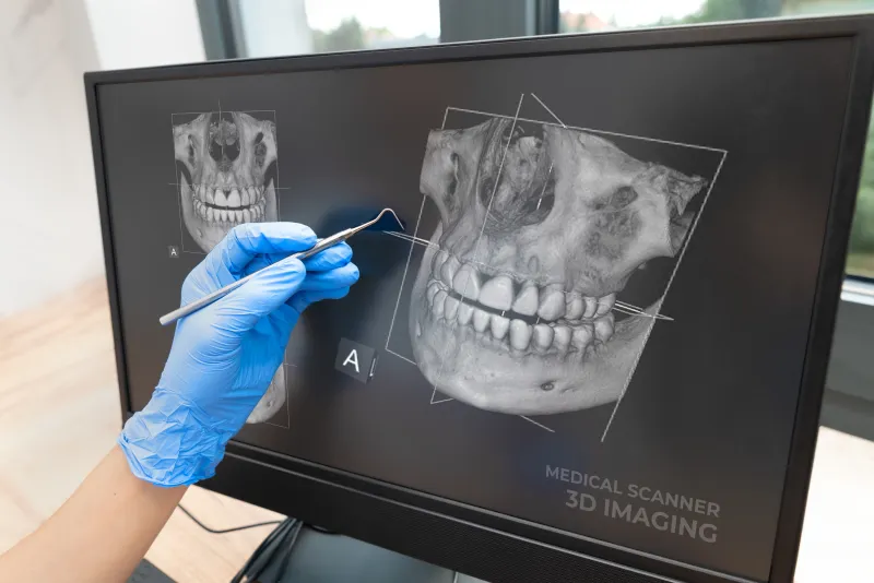 Digital X-Rays in Greenwood, IN